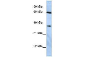 WB Suggested Anti-USP3 Antibody Titration:  0. (USP3 Antikörper  (Middle Region))