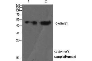 Western Blotting (WB) image for anti-Cyclin E1 (CCNE1) (Ser21) antibody (ABIN3174622) (Cyclin E1 Antikörper  (Ser21))