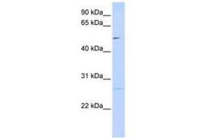 Image no. 1 for anti-Protein Phosphatase 1M (PP2C Domain Containing) (PPM1M) (AA 72-121) antibody (ABIN6741162) (PPM1M Antikörper  (AA 72-121))