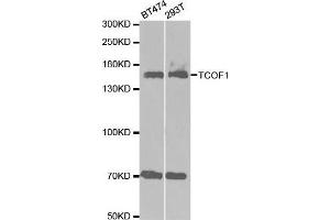 Western blot analysis of extracts of various cell lines, using TCOF1 antibody. (TCOF1 Antikörper  (AA 659-958))