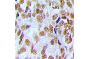 Immunohistochemistry (IHC) image for anti-U2 Small Nuclear RNA Auxiliary Factor 1 (U2AF1) antibody (ABIN7308460) (U2AF1 Antikörper)