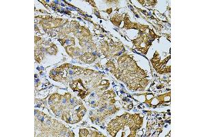 Immunohistochemistry of paraffin-embedded human stomach using CDH6 antibody (ABIN5974784) at dilution of 1/100 (40x lens). (CDH6 Antikörper)