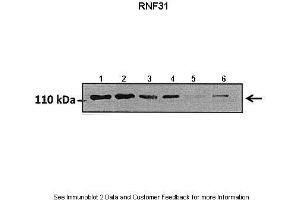 Lanes:   Lane1: 50 ug hormoxia A549 lysate Lane2: 50 ug hypoxia A549 lysate Lane3: 50 ug hormoxia A549 lysate (+scrambled siRNA) Lane4: 50 ug hypoxia A549 lysate (+scrambled siRNA) Lane5: 50 ug hormoxia A549 lysate (RNF31 siRNA) Lane6: 50 ug hypoxia A549 lysate (RNF31 siRNA)  Primary Antibody Dilution:   1:800  Secondary Antibody:   Goat anti rabbit HRP   Secondary Antibody Dilution:   1:10000  Gene Name:   RNF31  Submitted by:   Markus Queisser, Northwestern University (RNF31 Antikörper  (Middle Region))