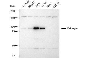 Western blotting analysis using Calmegin antibody (ABIN7797841). (Rekombinanter Calmegin Antikörper)