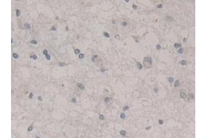 Immunohistochemistry (IHC) image for anti-Nestin (NES) (AA 178-399) antibody (ABIN7426685)