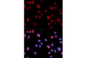 Immunofluorescence analysis of MCF-7 cells using Phospho-ABL1-Y204 antibody (ABIN5969866). (ABL1 Antikörper  (pTyr204))