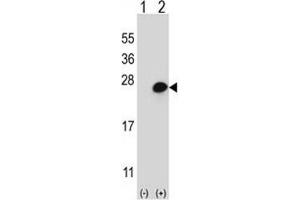 Western blot analysis of MGMT (arrow) using rabbit polyclonal MGMT Antibody (N-term). (MGMT Antikörper  (N-Term))