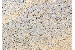 ABIN6259279 and ABIN6275588 at 1/100 staining Rat brain tissue by IHC-P.