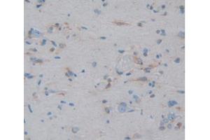 IHC-P analysis of Human Brain Tissue, with DAB staining. (HSP27 Antikörper  (AA 2-205))