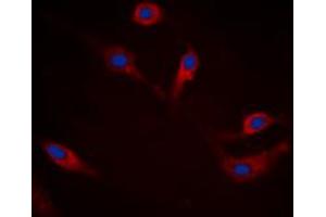 Immunofluorescent analysis of Alpha-synuclein (pS129) staining in HEK293T cells. (SNCA Antikörper  (C-Term, pSer129))