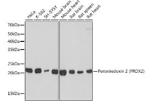 Western blot analysis of extracts of various cell lines, using Peroxiredoxin 2 (PRDX2) (PRDX2) Rabbit mAb (ABIN7269234) at 1:1000 dilution. (Peroxiredoxin 2 Antikörper)