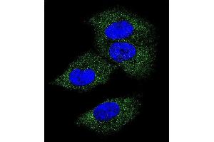 Confocal immunofluorescent analysis of M-CSF Antibody (Center) (ABIN390719 and ABIN2840996) with MDA-M cell followed by Alexa Fluor 488-conjugated goat anti-rabbit lgG (green). (M-CSF/CSF1 Antikörper  (AA 230-257))