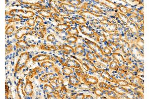 ABIN6262297 and ABIN6276874 at 1/100 staining Mouse kidney tissue by IHC-P.