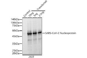 Western blot analysis of extracts of normal 293T cells and 293T transfected with Nucleoprotein Protein, using SARS-CoV-2 Nucleoprotein antibody (ABIN7269052) at 1:10000 dilution. (Nucleoprotein Antikörper)