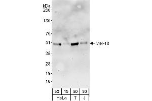 anti-Polycomb Group Ring Finger 2 (PCGF2) (AA 125-175) antibody