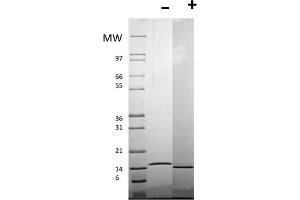 SDS-PAGE of Human CD40 Ligand Recombinant Protein (Animal Free) SDS-PAGE of Human AF CD40 Ligand Recombinant Protein. (CD40 Ligand Protein (CD40LG))