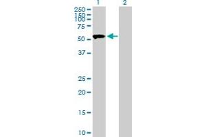 Western Blot analysis of SASS6 expression in transfected 293T cell line by SASS6 MaxPab polyclonal antibody.