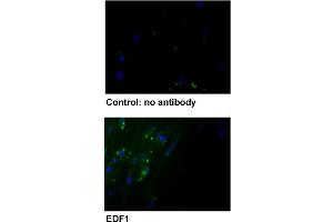 Immunofluorescent staining of human fibroblast with EDF1 polyclonal antibody . (EDF1 Antikörper  (AA 99-148))