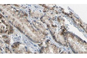 ABIN6276636 at 1/100 staining Human prostate tissue by IHC-P. (TNFRSF10B Antikörper  (N-Term))