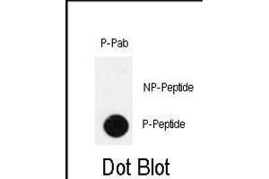 Dot blot analysis of anti-Phospho-IPF-pT11 Antibody (ABIN390000 and ABIN2839777) on nitrocellulose membrane.