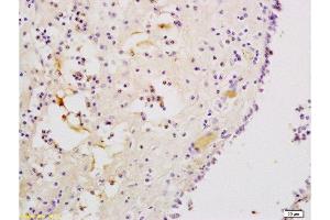 Formalin-fixed and paraffin embedded human nasal mucosa tissue labeled with Anti-CXCR3/CD183 Polyclonal Antibody, Unconjugated  at 1:200, followed by conjugation to the secondary antibody and DAB staining (CXCR3 Antikörper  (AA 1-100))