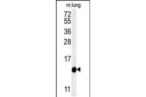 Western blot analysis of IFT20 Antibody in mouse lung tissue lysates (35ug/lane) (IFT20 Antikörper  (AA 44-71))