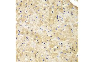 Immunohistochemistry of paraffin-embedded mouse heart using IDH1 antibody at dilution of 1:100 (400x lens).