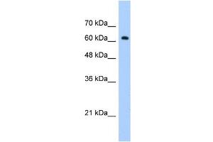WB Suggested Anti-ZNF675 Antibody Titration:  1.