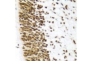 Immunohistochemistry of paraffin-embedded Human embryo brain using H3R8me2s antibody at dilution of 1:100 (x400 lens).