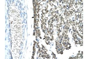 MORF4L1 antibody was used for immunohistochemistry at a concentration of 4-8 ug/ml to stain Myocardial cells (arrows) in Human Heart. (MORF4L1 Antikörper  (Middle Region))