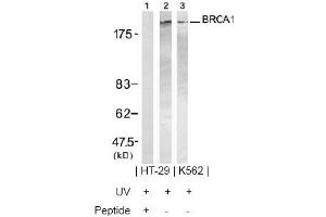 Image no. 2 for anti-Breast Cancer 1 (BRCA1) (Ser1423) antibody (ABIN197480) (BRCA1 Antikörper  (Ser1423))