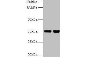 Western blot All lanes: ZBED1 antibody at 2 μg/mL Lane 1: EC109 whole cell lysate Lane 2: 293T whole cell lysate Secondary Goat polyclonal to rabbit IgG at 1/15000 dilution Predicted band size: 79 kDa Observed band size: 35 kDa (ZBED1 Antikörper  (AA 1-210))
