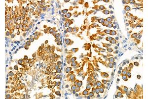 ABIN6262750 and ABIN6279175 at 1/100 staining Rat testis tissue by IHC-P.