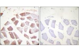 Immunohistochemistry analysis of paraffin-embedded human skeletal muscle, using Actin-pan (alpha/gamma) (Phospho-Tyr55/53) Antibody. (Actin Antikörper  (pTyr55))