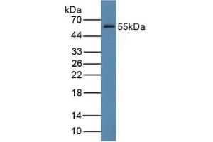 Detection of FDFT1 in Rat Liver Tissue using Polyclonal Antibody to Farnesyl Diphosphate Farnesyltransferase 1 (FDFT1) (FDFT1 Antikörper  (AA 269-417))