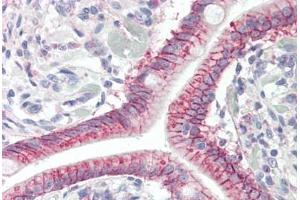 Human Small Intestine: Formalin-Fixed, Paraffin-Embedded (FFPE) (GPR52 Antikörper  (AA 1-30))