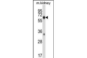 Mouse Map3k2 Antibody (N-term) (ABIN657838 and ABIN2846800) western blot analysis in mouse kidney tissue lysates (35 μg/lane). (MAP3K2 Antikörper  (N-Term))