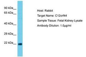 Image no. 1 for anti-Chromosome 12 Open Reading Frame 44 (C12orf44) (AA 29-78) antibody (ABIN6750653) (ATG101 Antikörper  (AA 29-78))
