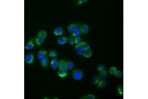 Image no. 1 for anti-Interferon-Induced Protein with Tetratricopeptide Repeats 1 (IFIT1) antibody (ABIN1498803) (IFIT1 Antikörper)