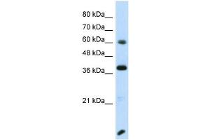 Host:  Rabbit  Target Name:  RFX4  Sample Type:  Transfected 293T Whole Cell lysates  Antibody Dilution:  1. (RFX4 Antikörper  (N-Term))