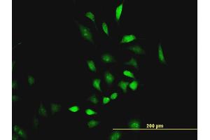 Immunofluorescence of monoclonal antibody to CBS on HeLa cell. (CBS Antikörper  (AA 1-100))