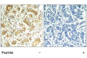Image no. 1 for anti-Spleen tyrosine Kinase (SYK) (AA 321-325) antibody (ABIN319416) (SYK Antikörper  (AA 321-325))