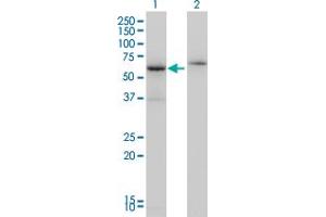 Western Blot analysis of CSTF2 expression in transfected 293T cell line by CSTF2 monoclonal antibody (M01), clone 3D1-3A6.