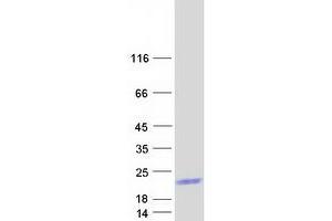 Validation with Western Blot (LCE3B Protein (Myc-DYKDDDDK Tag))