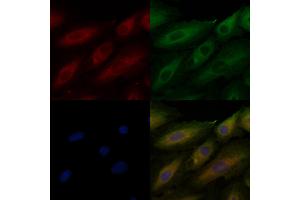 ABIN6260576 and ABIN6276962 staining  cells by IF/ICC. (CD151 Antikörper  (N-Term))