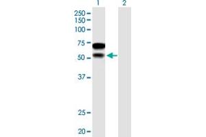 Western Blot analysis of CHD2 expression in transfected 293T cell line by CHD2 MaxPab polyclonal antibody. (CHD2 Antikörper  (AA 1-501))