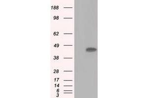 Image no. 7 for anti-Acetyl-CoA Acetyltransferase 2 (ACAT2) antibody (ABIN1496400) (ACAT2 Antikörper)