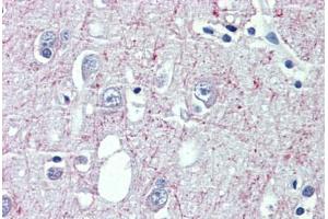 Brain, cortex, Human: Formalin-Fixed, Paraffin-Embedded (FFPE) (GABBR1 Antikörper  (AA 947-961))
