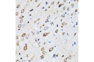 Immunohistochemistry (Paraffin-embedded Sections) (IHC (p)) image for anti-NDE1 (NDE1) (AA 1-110) antibody (ABIN6144443)