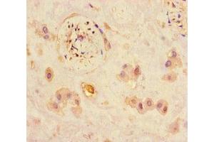 Immunohistochemistry of paraffin-embedded human placenta tissue using ABIN7165672 at dilution of 1:100 (JARID2 Antikörper  (AA 1-159))